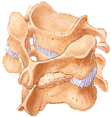 Posterior Cervical Fusion